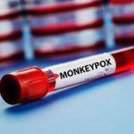 Monkeypox.(IANS Infographics)